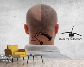 پوستر دیواری کاشت مو برای کلینیک زیبایی